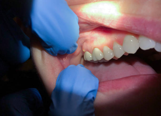Best Emergency Dental Care for Trauma or Injury in Fairmount, IN